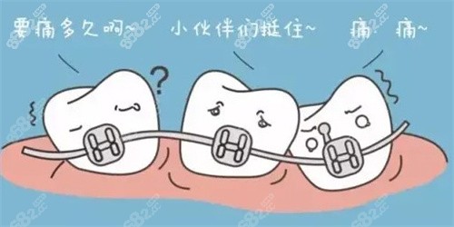 牙齿矫正前