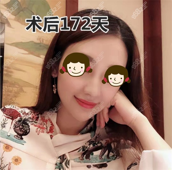 广州曙光蒋思军做鼻子好吗？