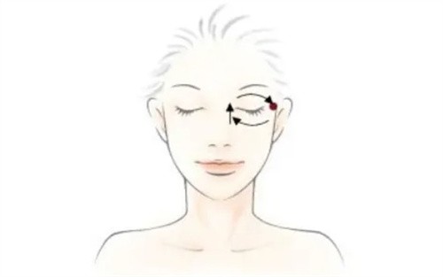 眼部整形示意圖