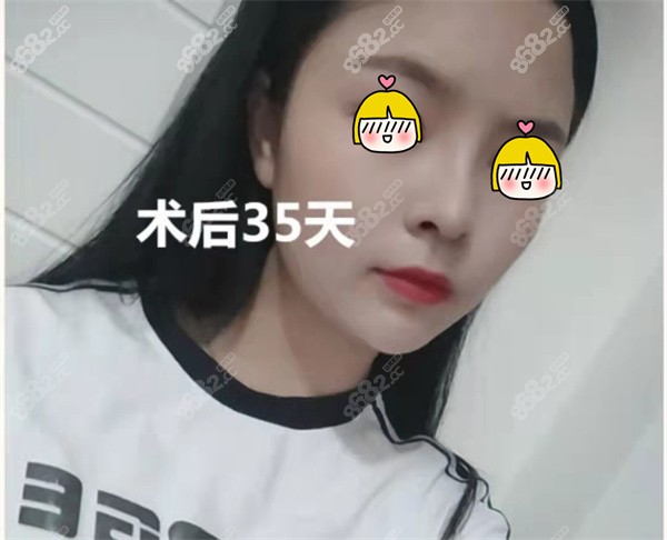 广州曙光蒋思军做鼻子好吗？