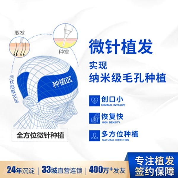 上海植發(fā)一般多少費(fèi)用 上海植發(fā)一般多少費(fèi)用