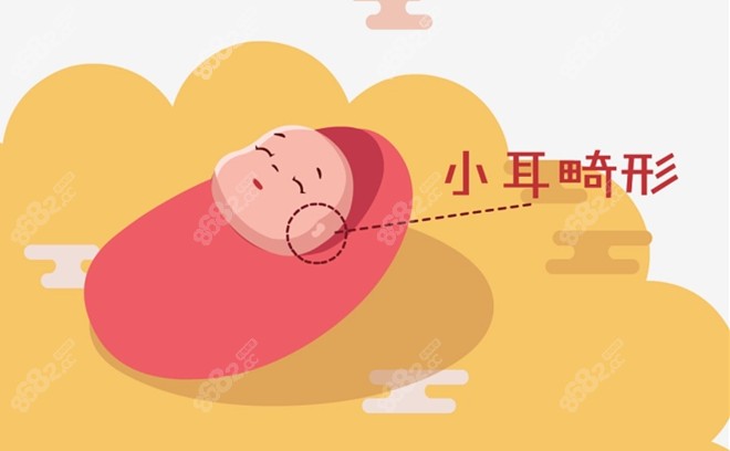 安波做耳朵的实例