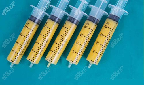 <!--<i data=20240705-sp></i>-->冯斌手工吸脂脂肪纯度高