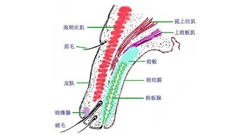 KISS仿生双眼皮的手术原理