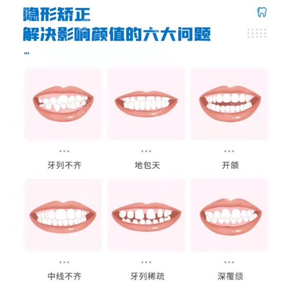 厦门牙齿矫正价格表