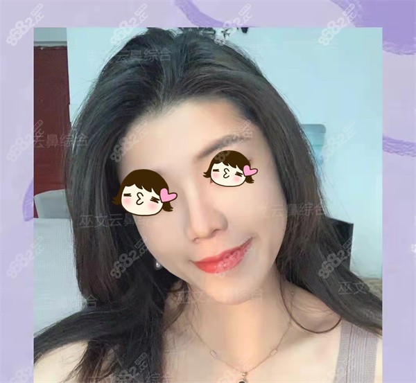 北京巫文云實例