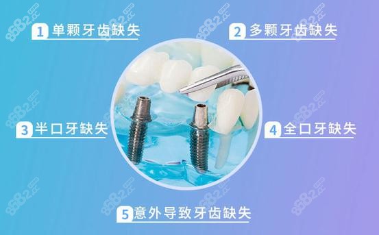 佛山华美口腔做种植牙怎么样