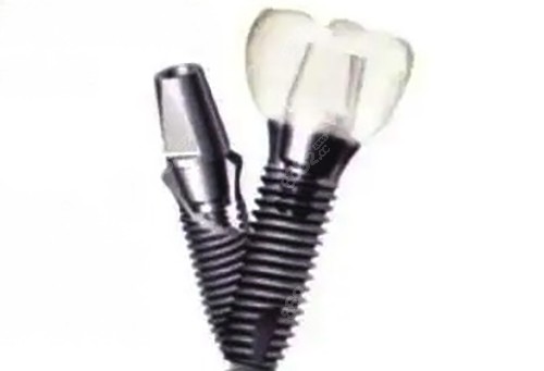 韩国登腾种植牙