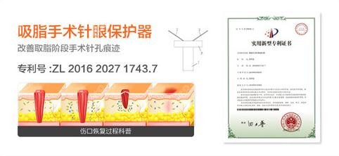 北京禾美嘉关几梦吸脂怎么样