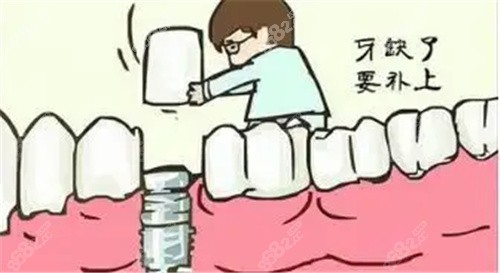 西安中诺口腔医院种植牙