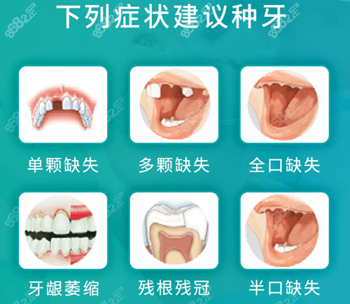 常见几种种植牙情况