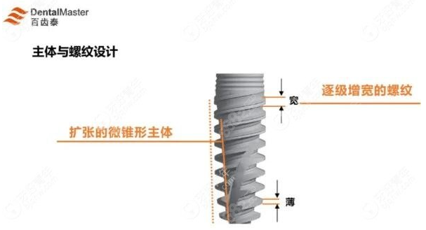 百齿泰种植体外形优势