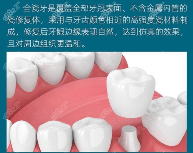 大渡口区全瓷牙的收费价格表