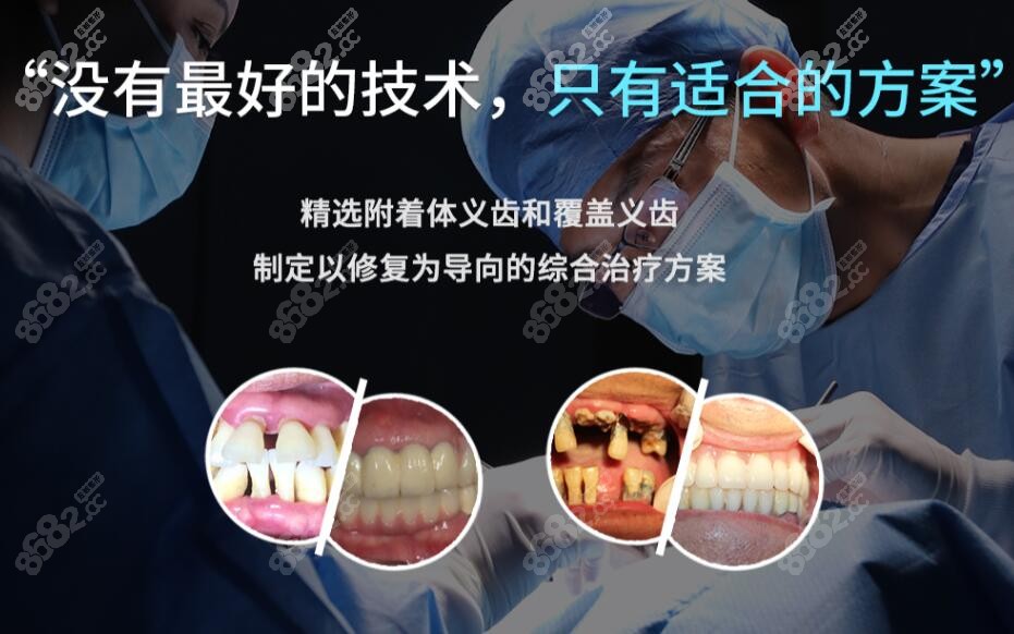 美冠塔口腔特色技术