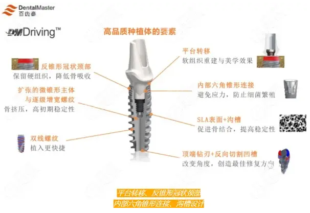 百齿泰种植体怎么样