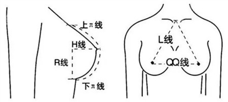 罗志敏隆胸比例