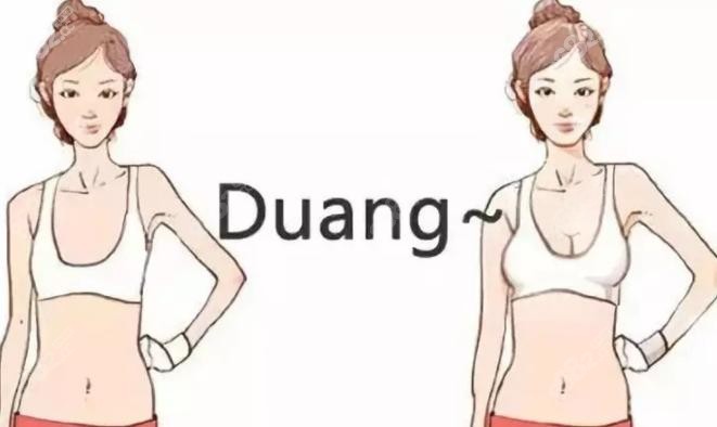 哈尔滨双燕假体隆胸示意图