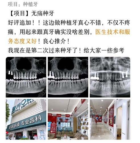 佛山登特口腔医院种植牙评价