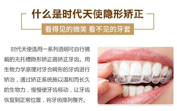 西安优德口腔时代天使隐形矫正介绍