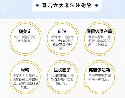 北京煤医异物取出类型