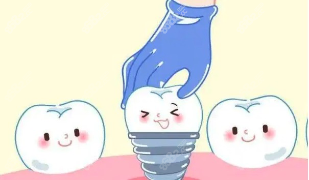 种植牙过程