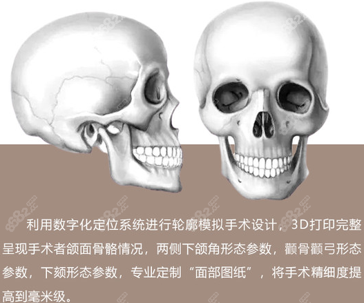 3D 打印技术的优势