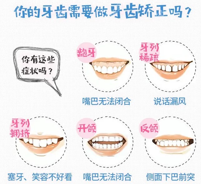 需要做牙齿矫正图