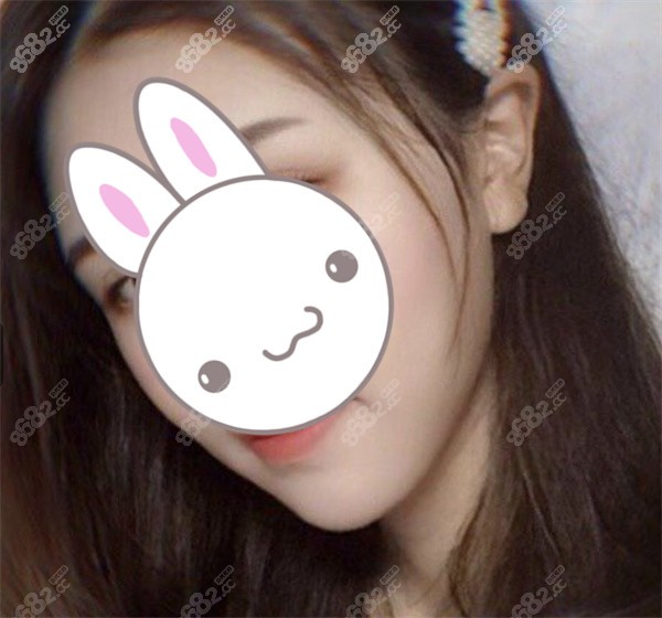 武汉中翰吴中兴下颌角手术