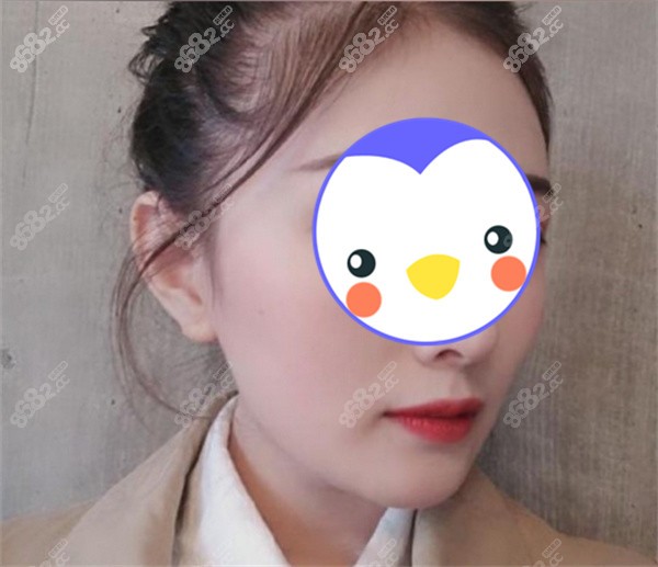 武汉中翰吴中兴下颌角手术