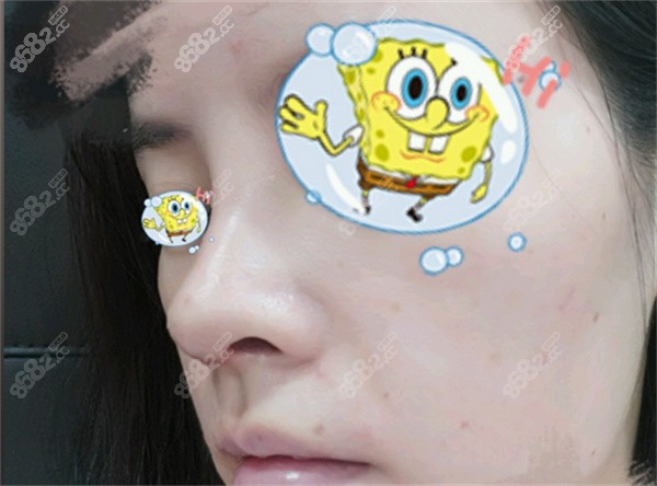 廣州華美做鼻子