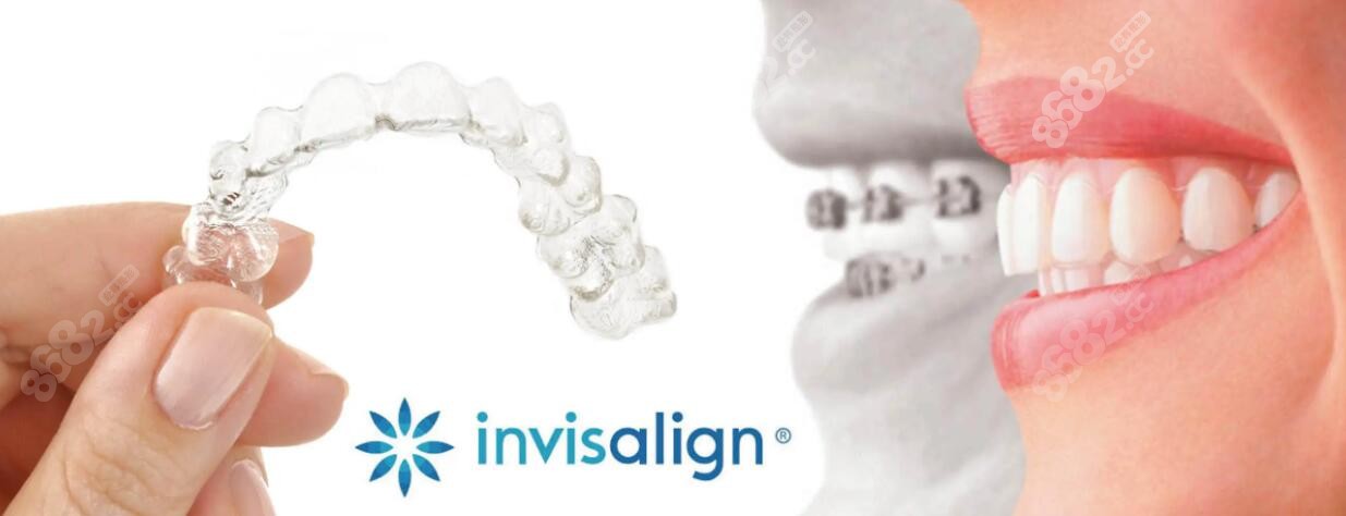 元多一点面诊长沙牙大夫口腔周权医生后,建议我做的是隐适美隐形矫正