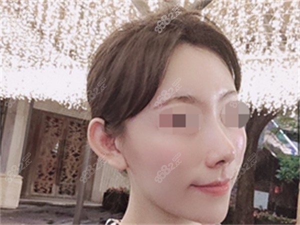 廣州華美做鼻子