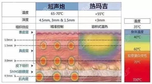 热玛吉和超声炮联合抗衰.jpg