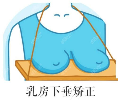 上海乳房下垂矫正好的医院排名前十推荐