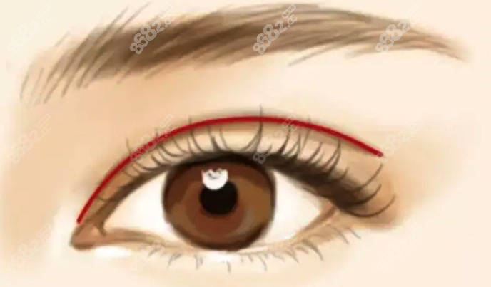 田秋梅做雙眼皮怎么樣 田秋梅做雙眼皮怎么樣