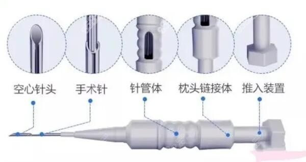 微针植发技术的优缺点