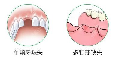 <!--<i data=20240705-sp></i>-->口腔收费不算贵但具体多少要结合牙齿情况来定