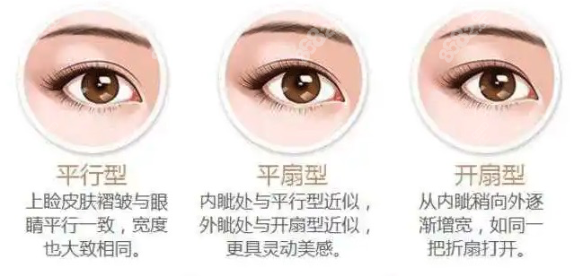 田秋梅做雙眼皮真好 田秋梅做雙眼皮真好