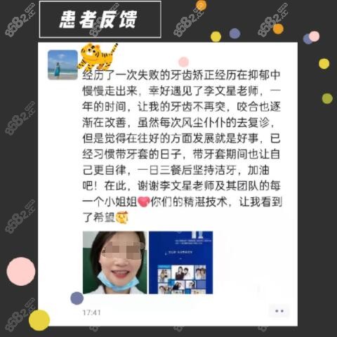 李文星医生正畸顾客反馈: