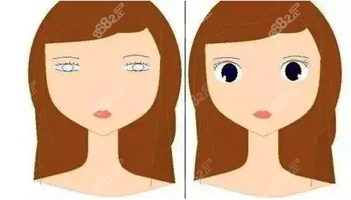 田秋梅做雙眼皮技術(shù)好嗎 田秋梅做雙眼皮技術(shù)好嗎