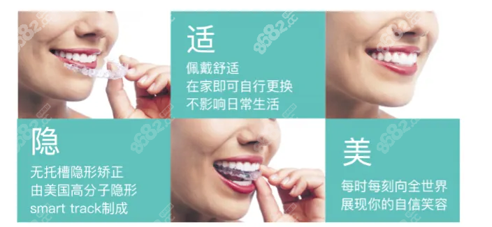 隐适美隐形矫正