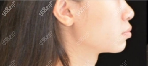 邰怡正畸范例