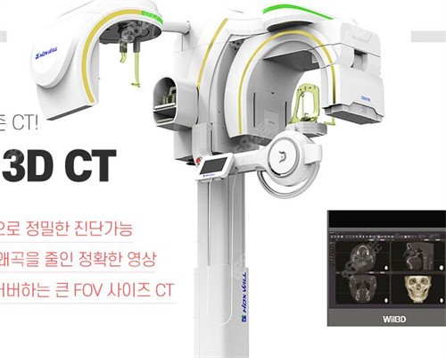 韩国1%整形3DCT