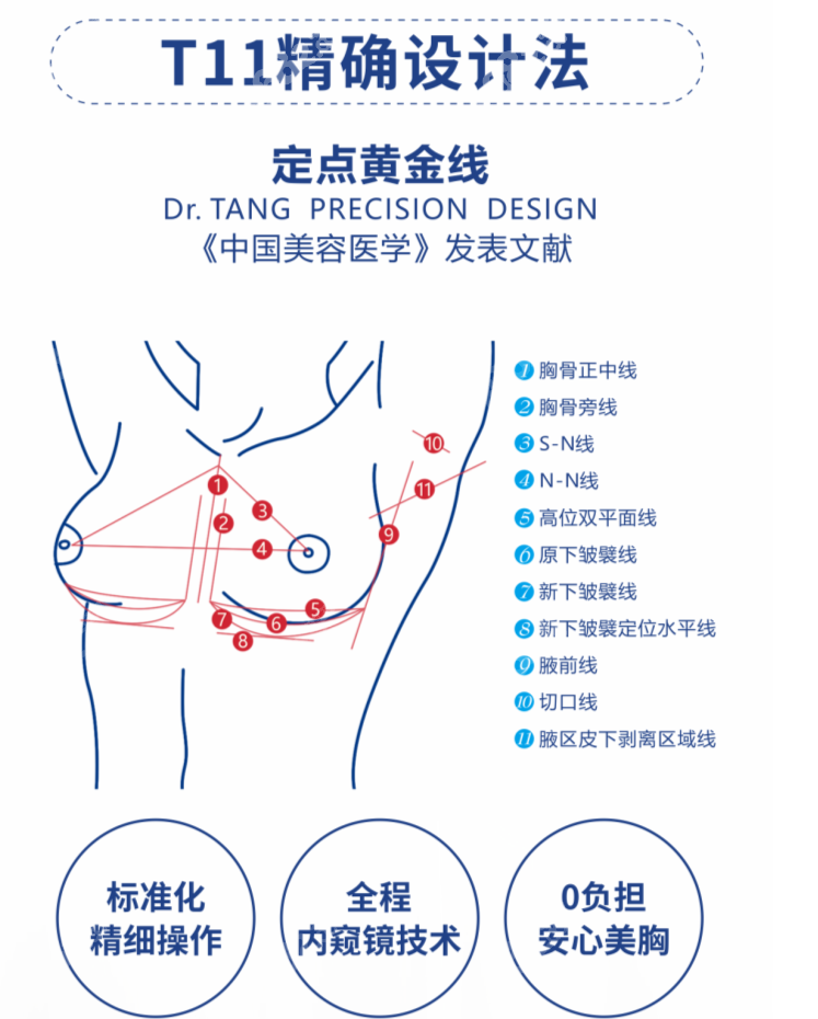 T11丰胸手术