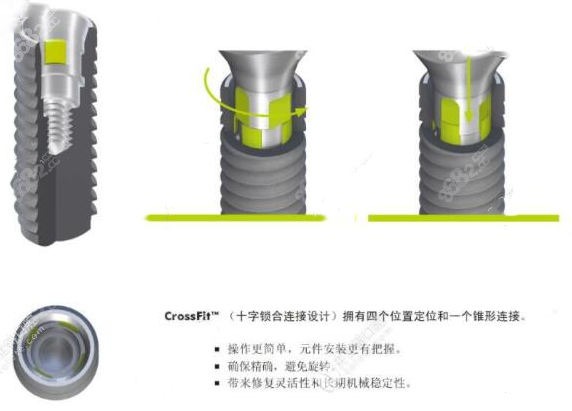 十字锁合连接图示