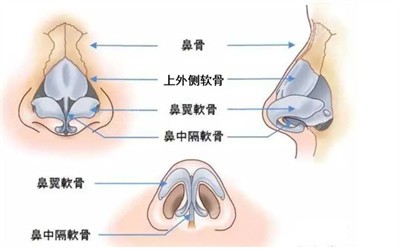 李任医生做美人鱼尾软骨鼻的技术优势3