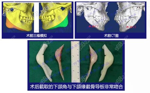 何锦泉的技术优势