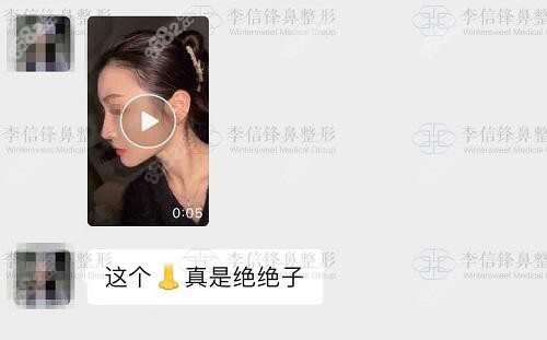 网评李信锋鼻修复真的做得好