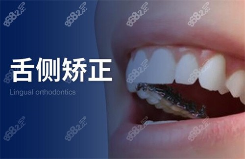 福州维乐口腔舌侧矫正