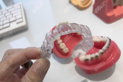 惠州大亚湾宏恩口腔牙齿矫正术前商谈